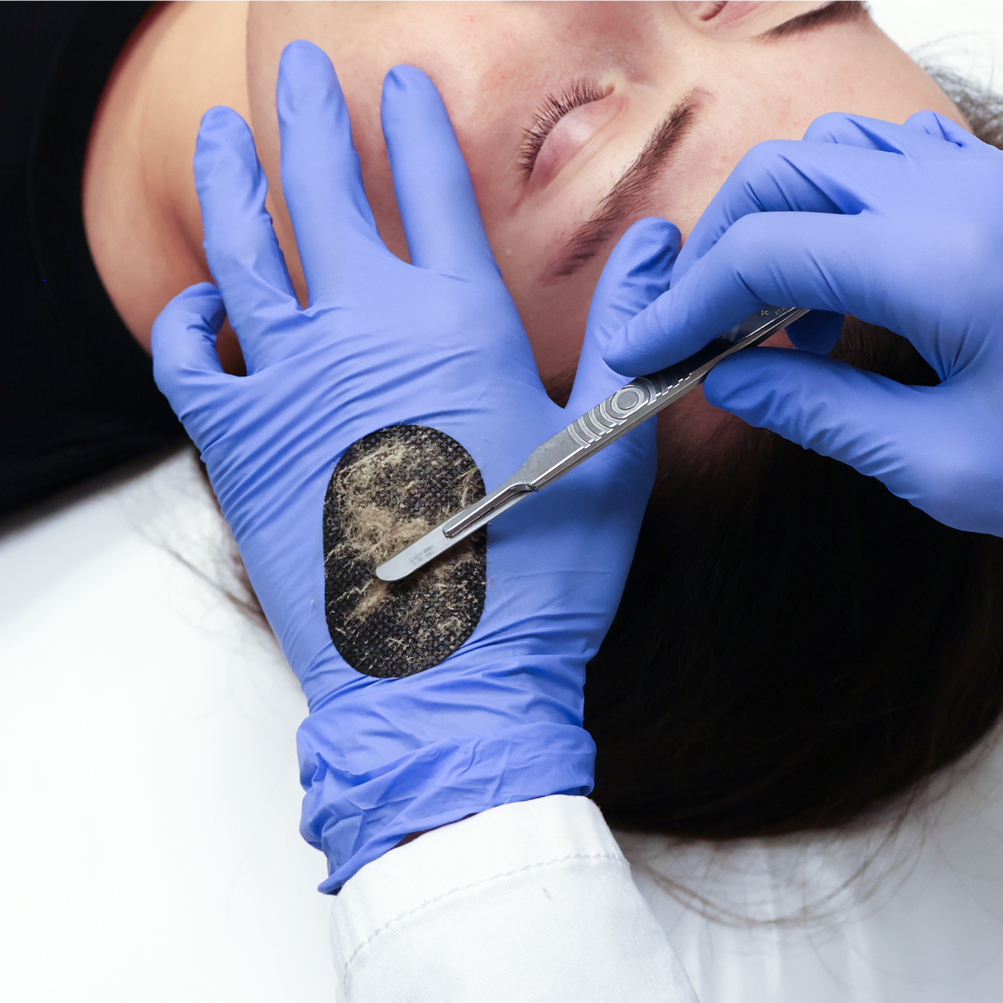 DermaPad® for Dermaplaning